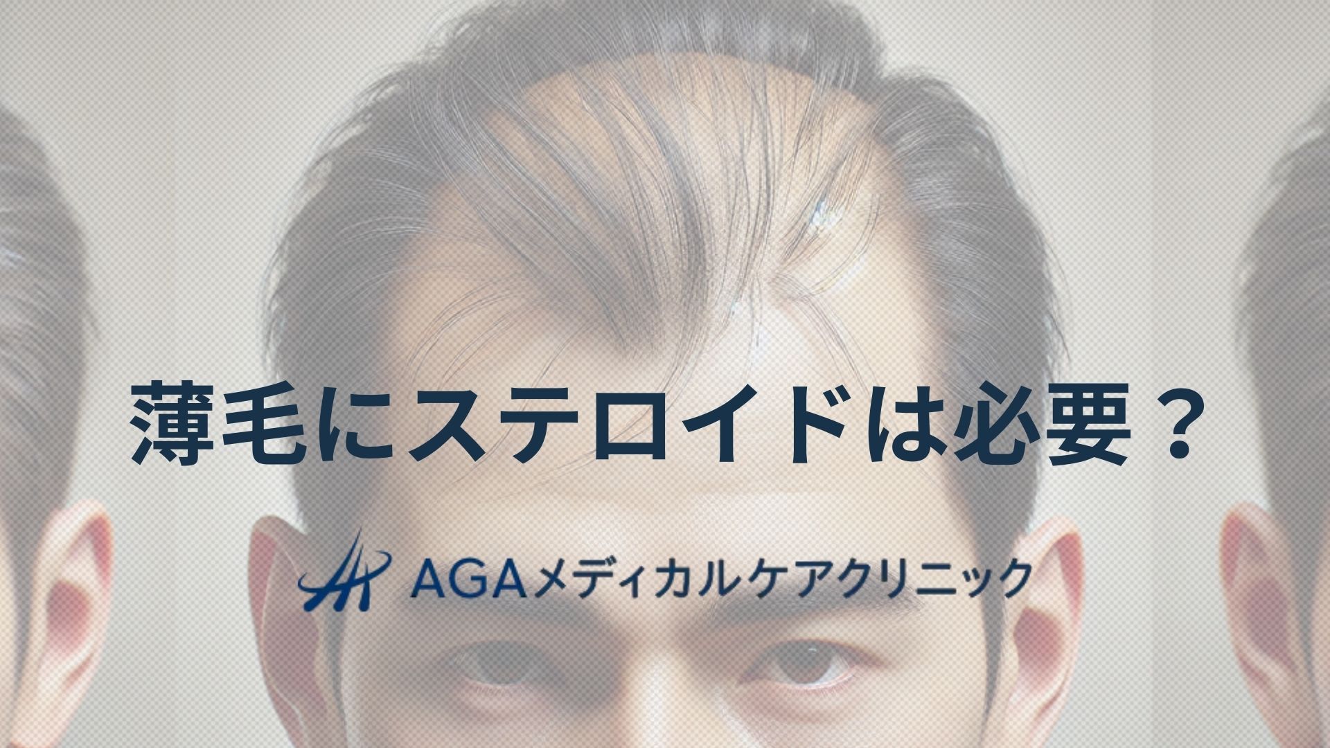 薄毛　ステロイド