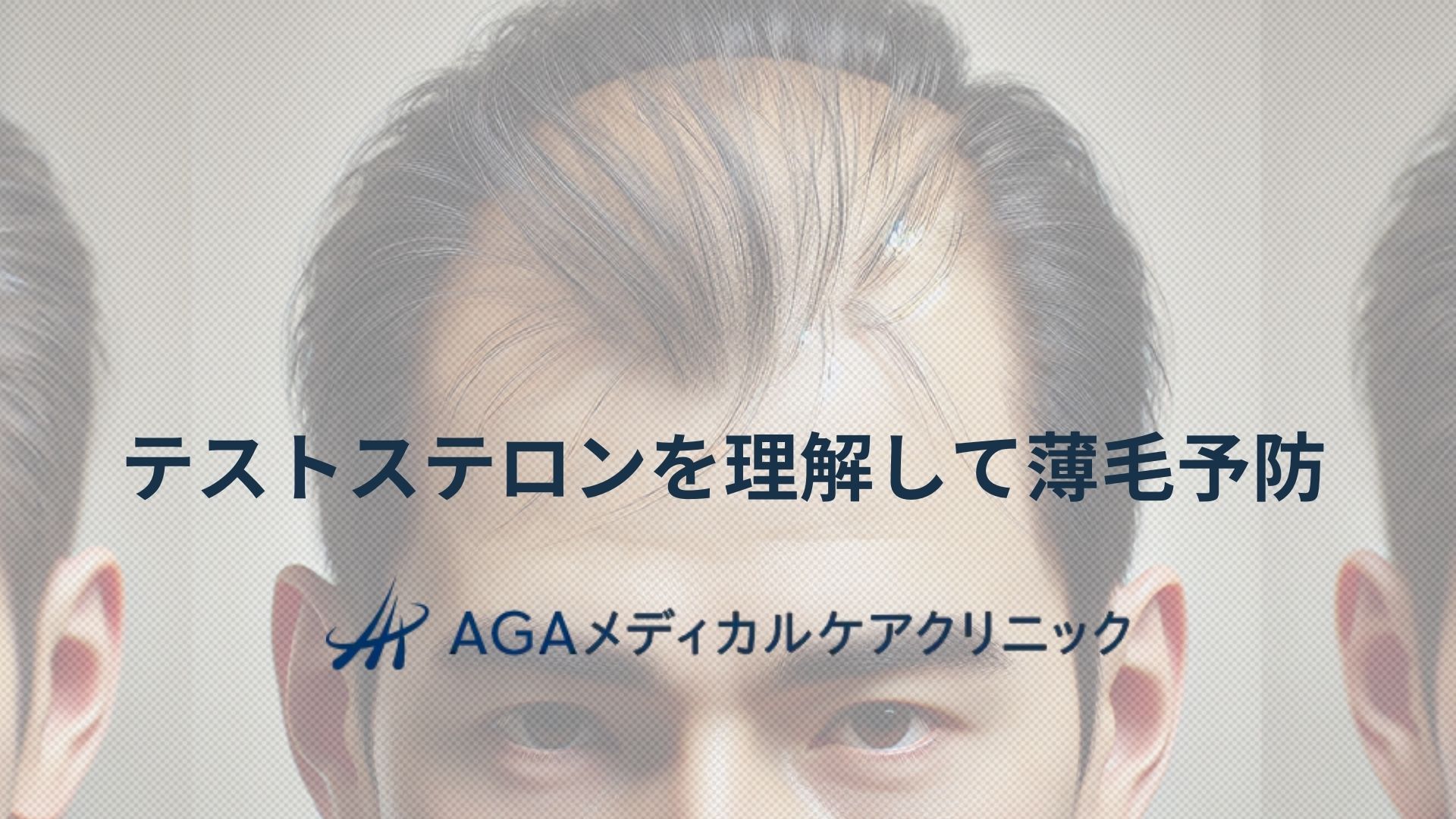 薄毛 テストステロン