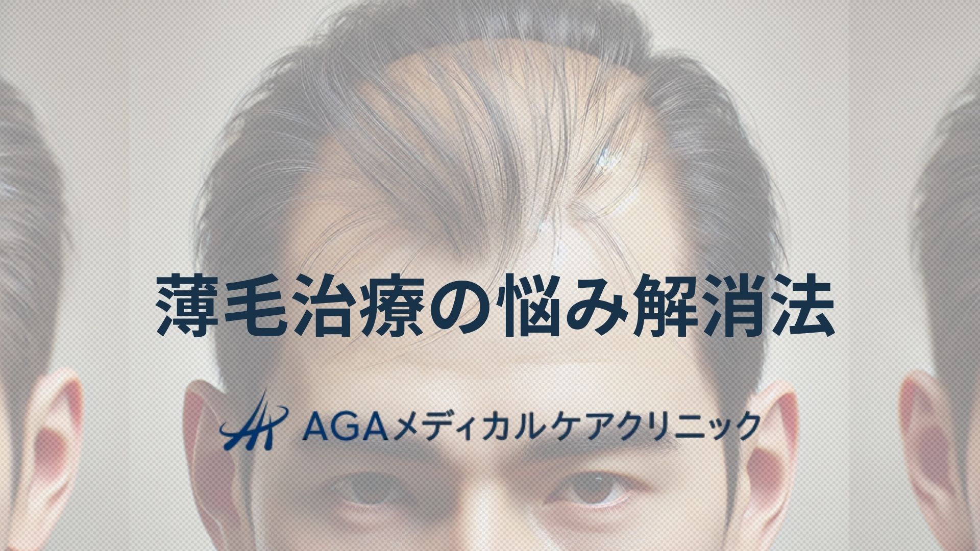 薄毛　悩み