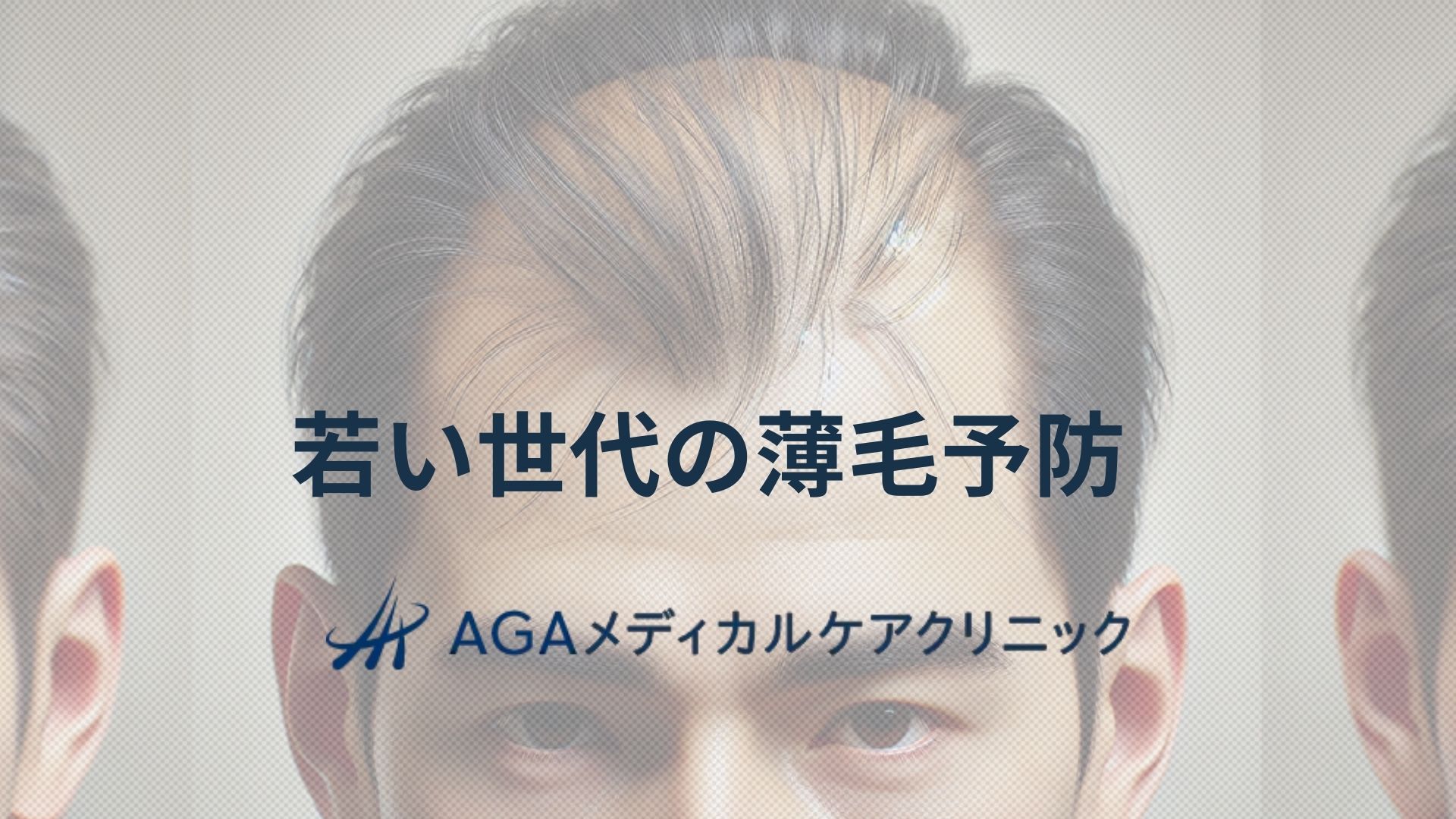 薄毛　若い