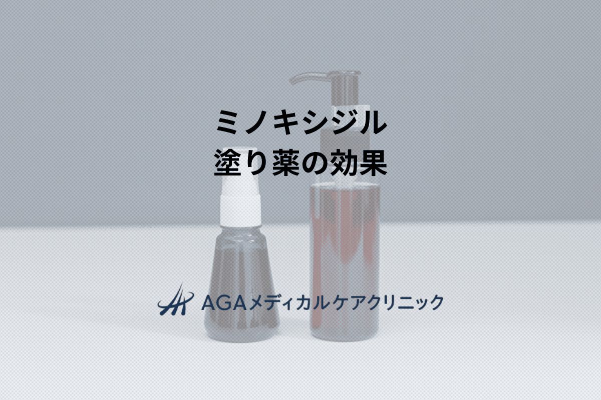 ミノキシジル塗り薬の効果