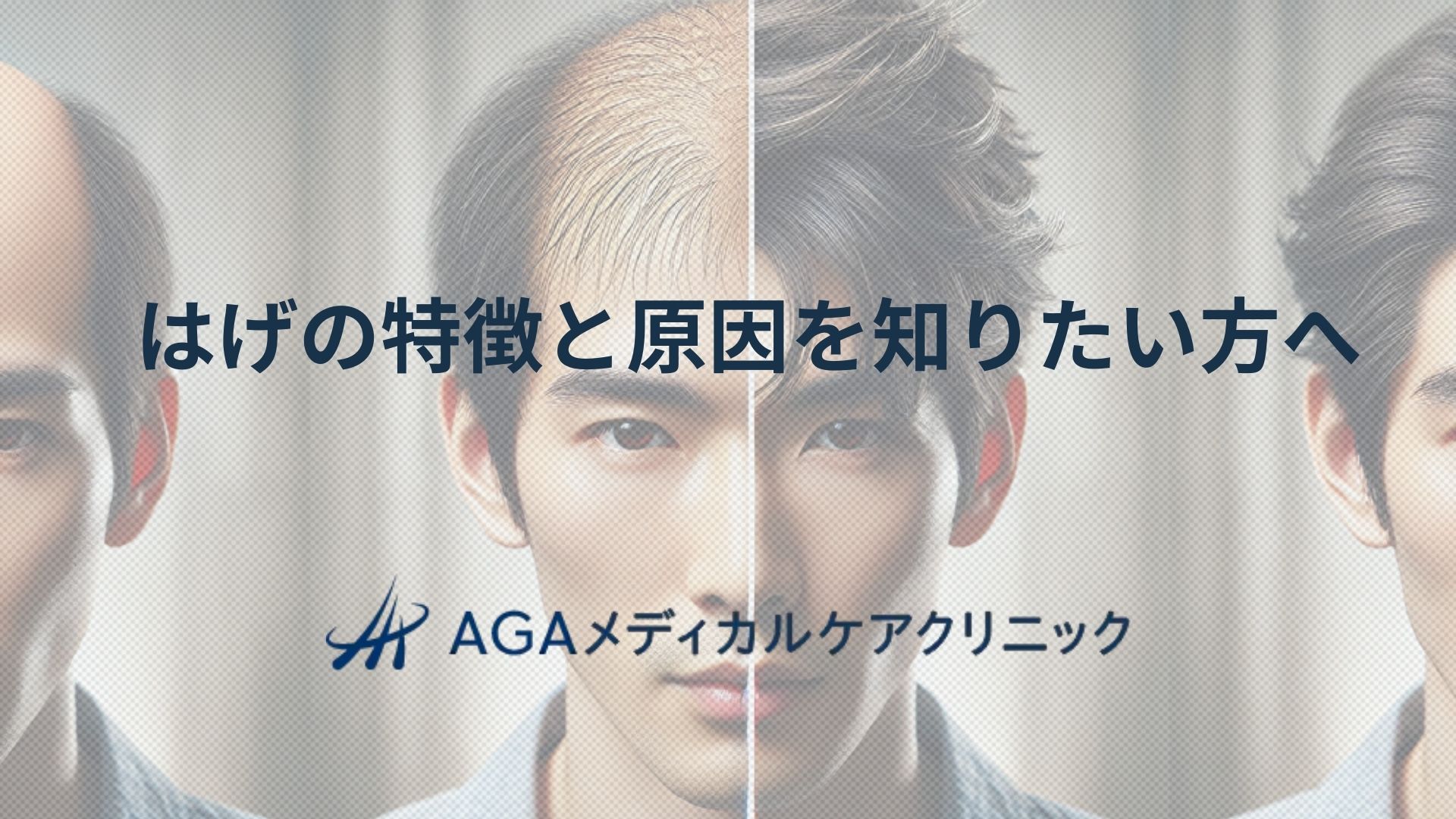 はげの特徴と原因を知りたい方へ、男性の薄毛を抑えるAGA治療法と対策を専門医が詳しく解説