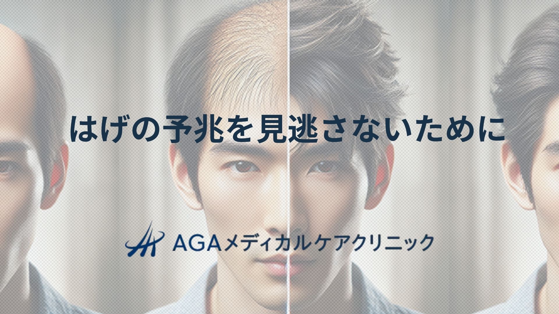 はげの予兆を見逃さないために薄毛の特徴と対策を解説