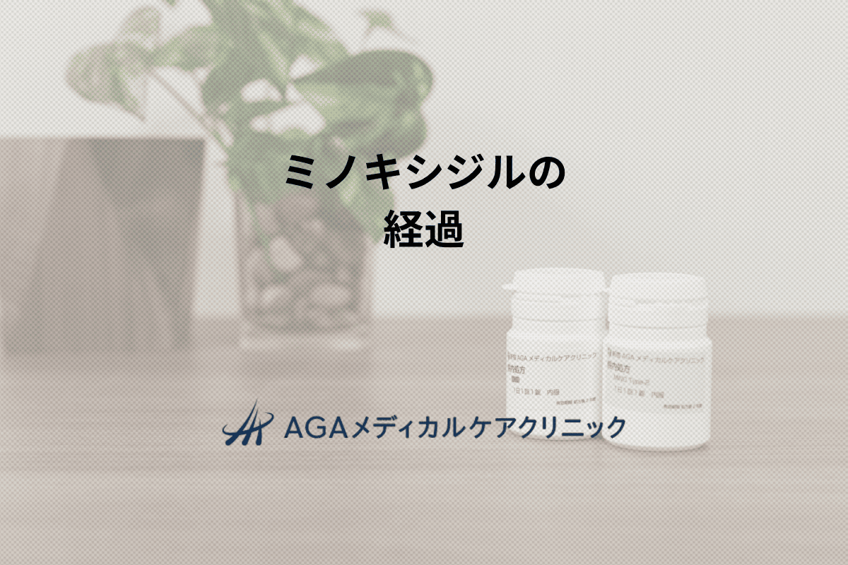ミノキシジルで薄毛が改善される経過|AGA治療の流れ