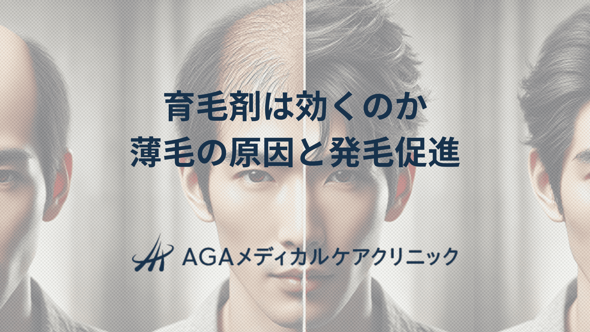 育毛剤は効くのかを考える　薄毛の原因と発毛促進