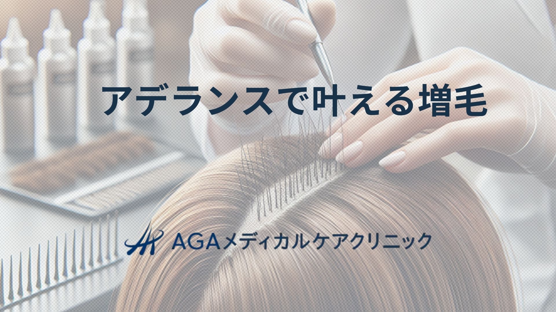 アデランスで叶える増毛で快適な髪生活―AGA・抜け毛への多角的アプローチ