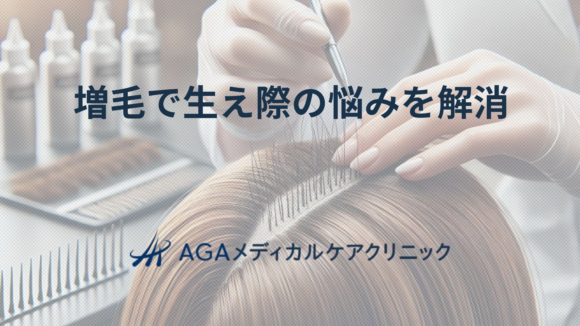 増毛で生え際の悩みを減らし自分の髪を活かす選択肢