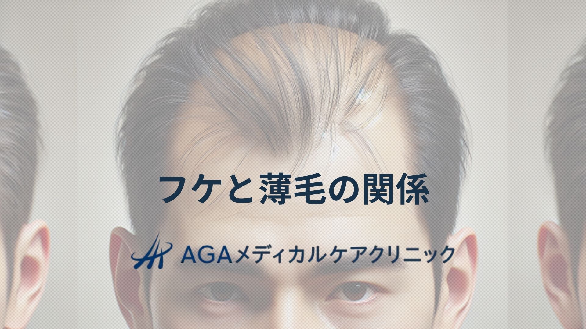 フケと薄毛の関係に着目した頭皮改善方法