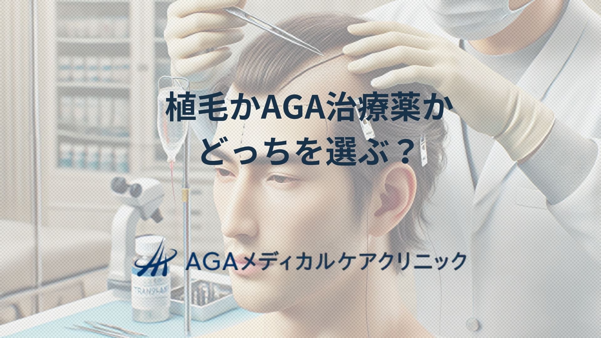 植毛 aga どっち