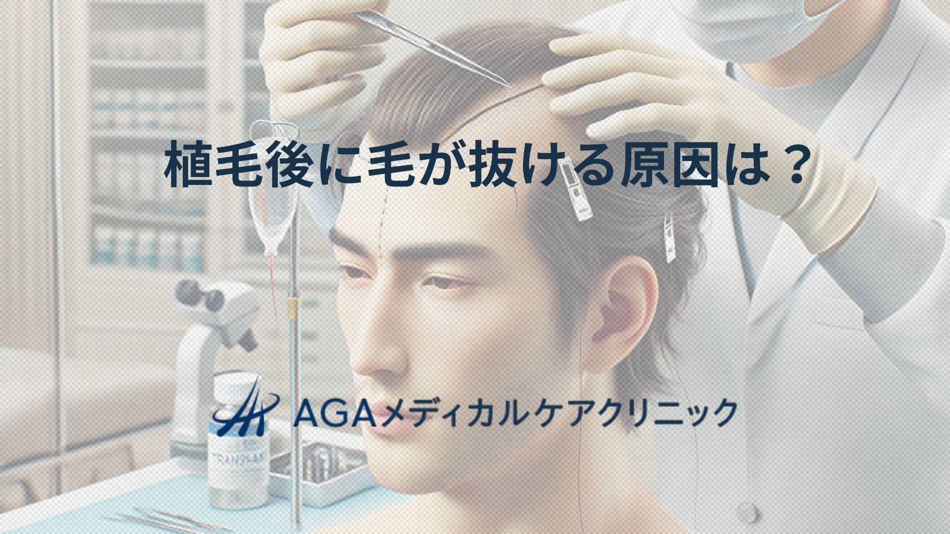 植毛後に毛が抜ける原因をAGA専門クリニックが詳しく解説