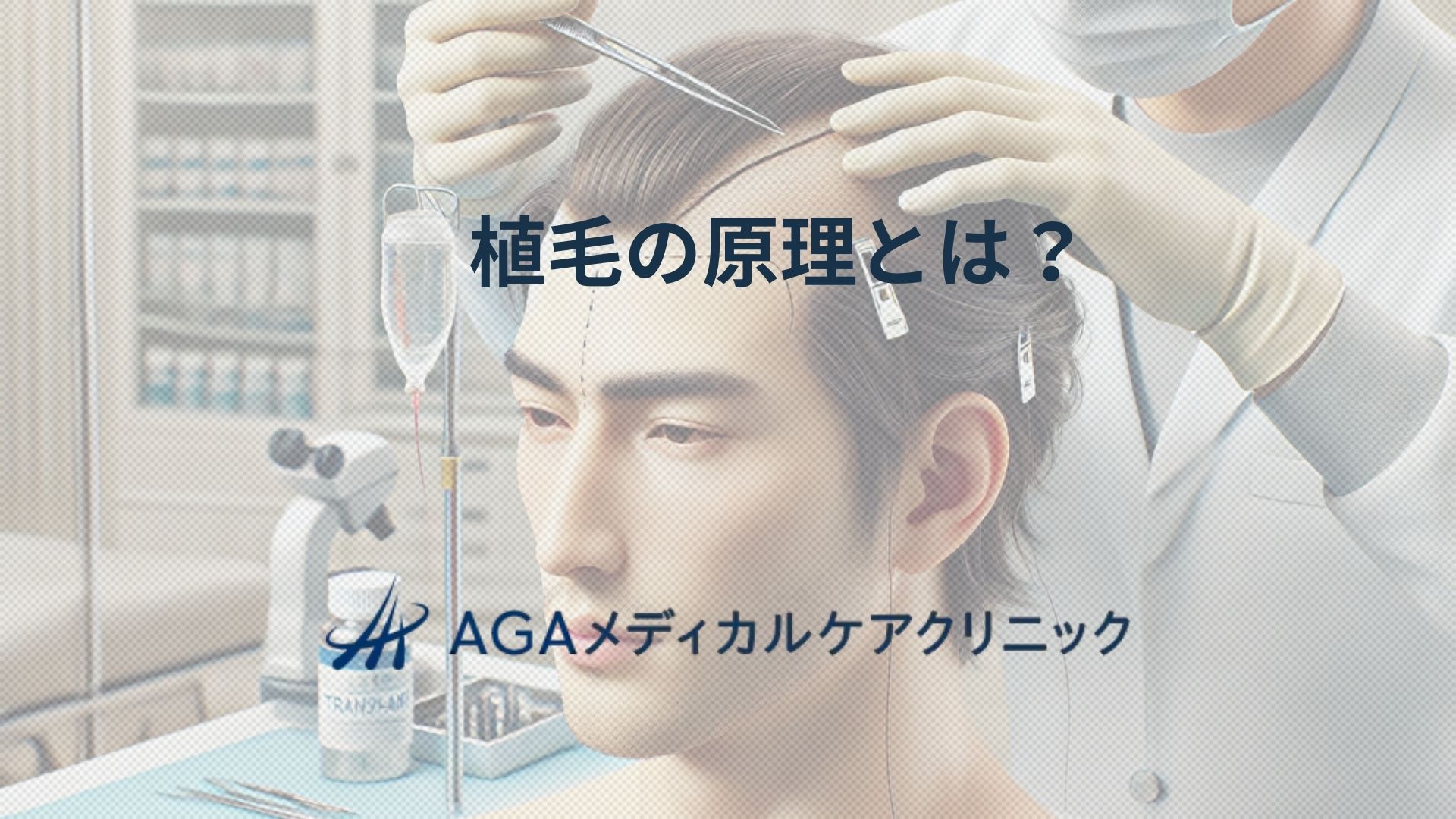 植毛の原理とは?AGAに悩む方が知っておきたい仕組みと特徴