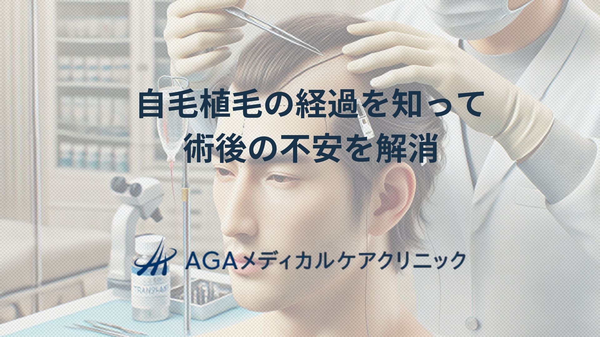 自毛植毛の経過と術後の不安を解消 クリニックが伝えたい大切な話