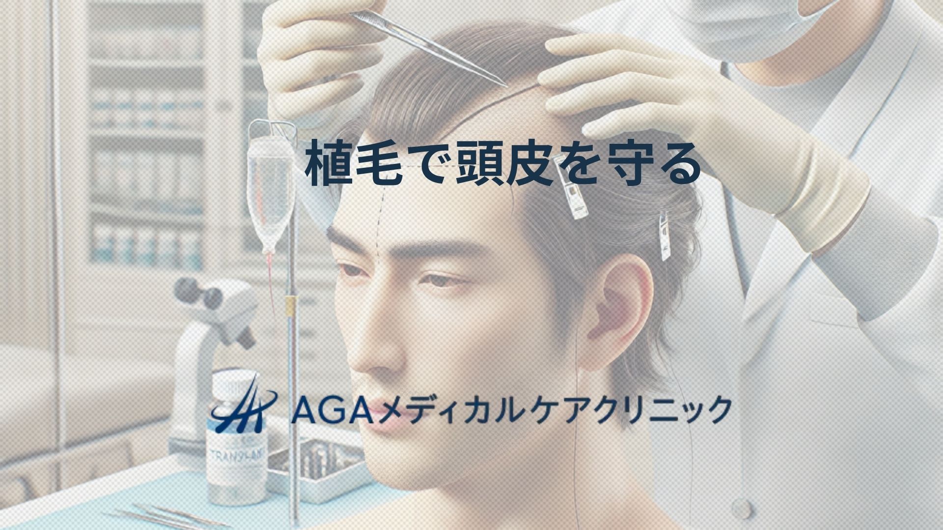 植毛で頭皮を守りながら薄毛を改善 髪を取り戻そう