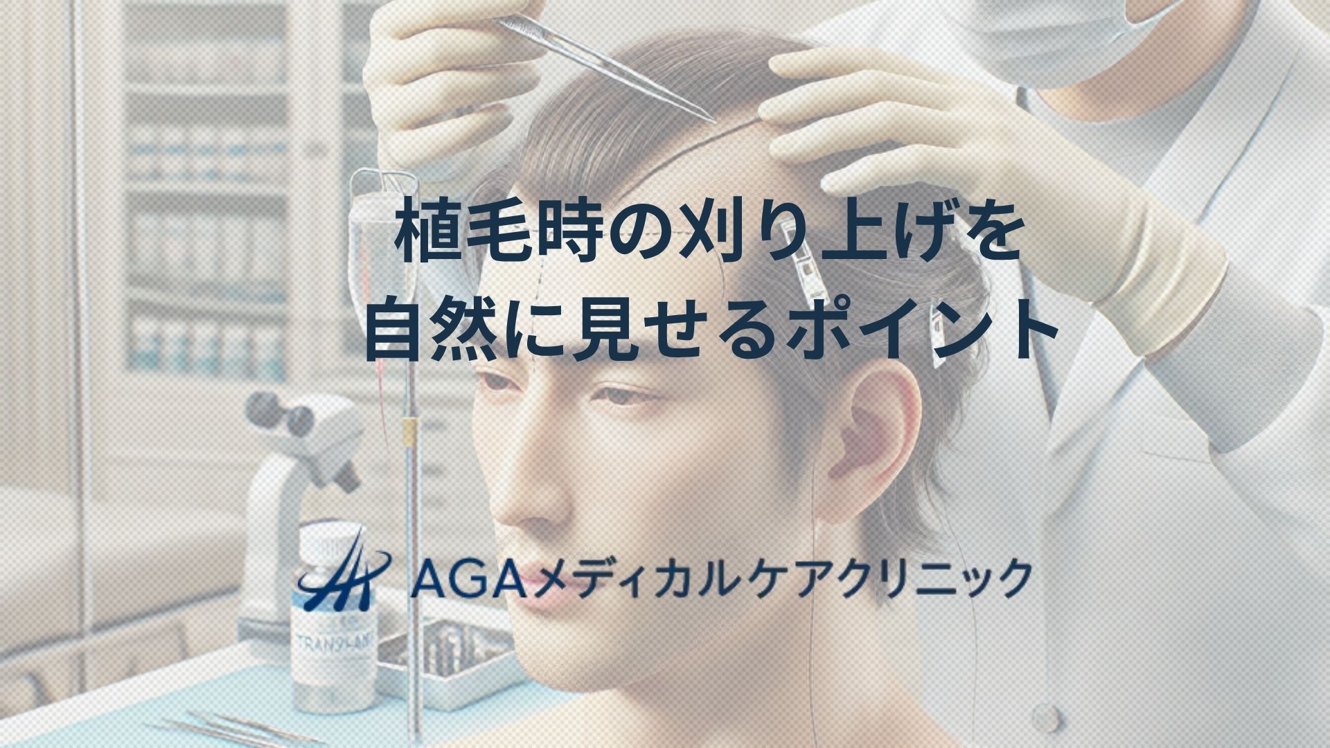 植毛時に刈り上げる不安を解消しよう!自然に見せるためのポイント